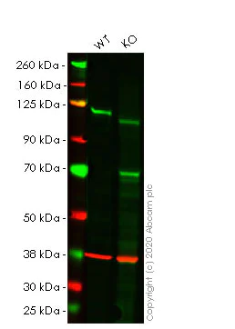 Western blot - Human NFKB2 (NFkB p100/NFKB2) knockout Hep G2 cell lysate (AB257247)