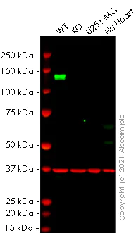 Western blot - Human NPR1 (Natriuretic Peptide Receptor A/GC-A) knockout HeLa cell line (AB265930)