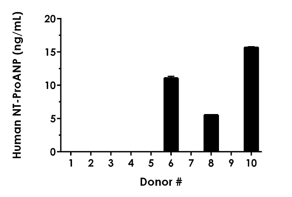 Sandwich ELISA - Human NT-ProANP ELISA Kit (AB245705)