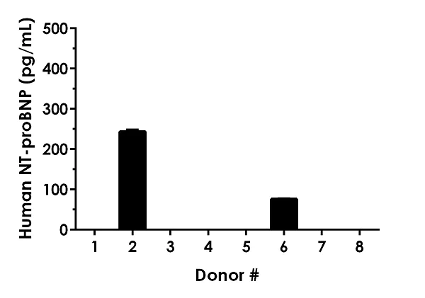 Sandwich ELISA - Human NT-proBNP ELISA Kit (AB263877)