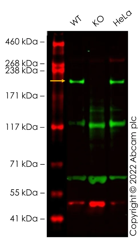 Western blot - Human NUP210 (GP210) knockout HEK-293T cell lysate (AB258549)