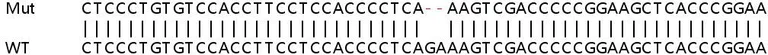 Sanger Sequencing - Human OSBPL5 (ORP5) knockout HeLa cell line (AB265771)