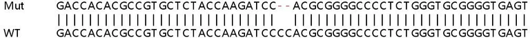 Sanger Sequencing - Human OTOP3 knockout A549 cell line (AB266929)
