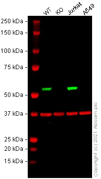 Western blot - Human OXCT1 (SCOT) knockout HeLa cell line (AB265358)