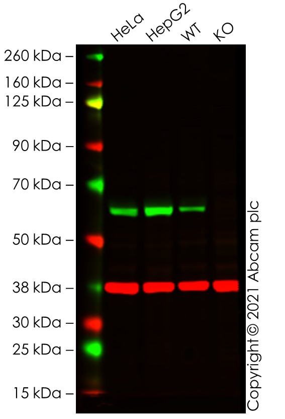 Western blot - Human P4HB knockout A-431 cell line (AB261887), expandable thumbnail