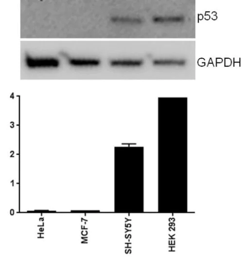 ELISA - Human p53 ELISA Kit (AB171571)