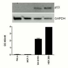 Sandwich ELISA - Human p53 ELISA Kit, Chemiluminescent (AB325617)