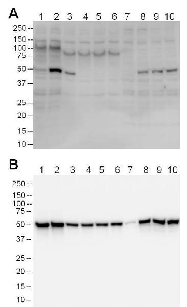 Western blot - Human p53 ELISA Kit (pSer15) (AB156027), expandable thumbnail