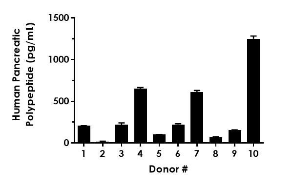 Sandwich ELISA - Human Pancreatic Polypeptide ELISA Kit (AB288177), expandable thumbnail