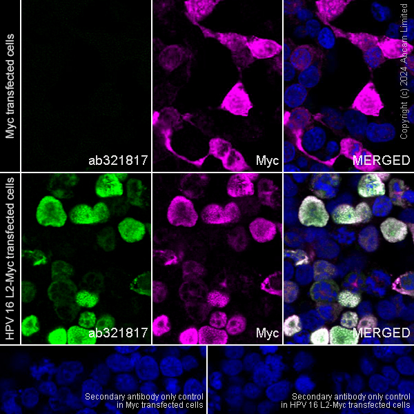 Immunocytochemistry/ Immunofluorescence - Anti-Human Papilloma Virus L2 antibody [K4_HPV16L2(20-38)] (AB321817), expandable thumbnail