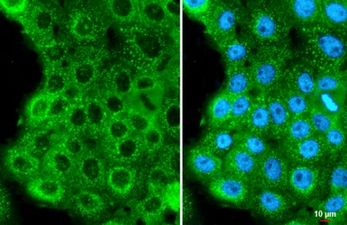 Immunocytochemistry/ Immunofluorescence - Anti-Human Papilloma virus type 16 E7 antibody [HL1647] (AB308180), expandable thumbnail