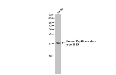 Western blot - Anti-Human Papilloma virus type 16 E7 antibody [HL1647] (AB308180), expandable thumbnail