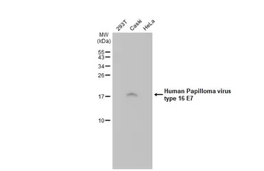 Western blot - Anti-Human Papilloma virus type 16 E7 antibody [HL1647] (AB308180), expandable thumbnail