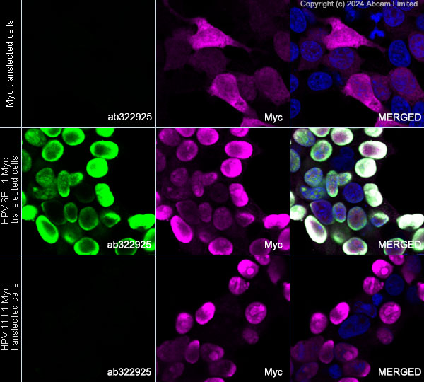 Immunocytochemistry/ Immunofluorescence - Anti-Human papillomavirus 6 L1 protein antibody [LH6L1_D] (AB322925), expandable thumbnail