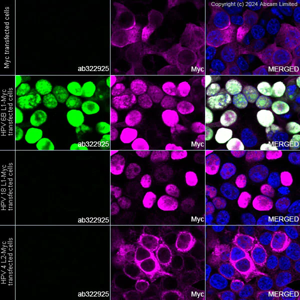 Immunocytochemistry/ Immunofluorescence - Anti-Human papillomavirus 6 L1 protein antibody [LH6L1_D] - BSA and Azide free (AB324811)