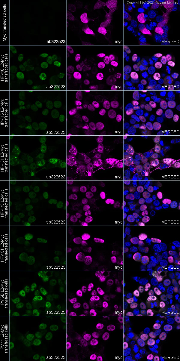 Immunocytochemistry/ Immunofluorescence - Anti-Human papillomavirus L2 antibody [MK18L2_K3] (AB322523)