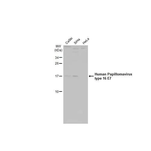 Western blot - Anti-Human Papillomavirus type 16 E7 antibody [HL1821] (AB317111)