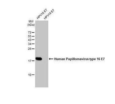 Western blot - Anti-Human Papillomavirus type 16 E7 antibody [HL1821] (AB317111)
