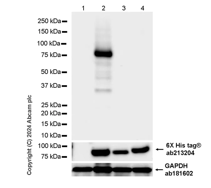 Western blot - Anti-Human papillomavirus type 31 L2 antibody [K3_HPV31L2(20-38)] - BSA and Azide free (AB324828)