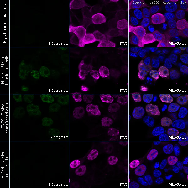 Immunocytochemistry/ Immunofluorescence - Anti-Human papillomavirus type 4 L2 antibody [HPV4L2(20-38)_4SA] (AB322958)