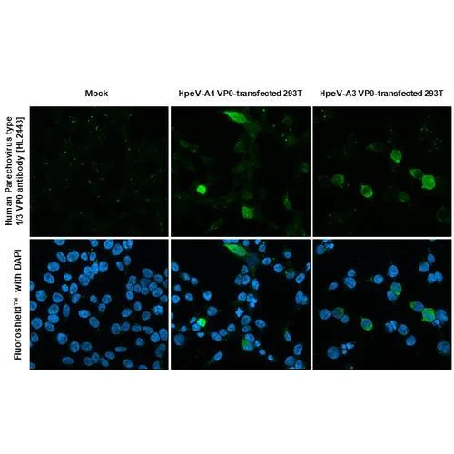 Immunocytochemistry/ Immunofluorescence - Anti-Human Parechovirus 1+3 VP0 antibody [HL2443] (AB317228)
