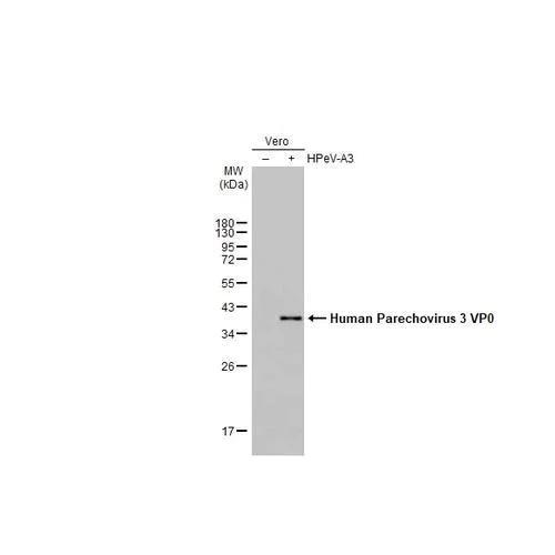 Western blot - Anti-Human Parechovirus 1+3 VP0 antibody [HL2443] (AB317228)