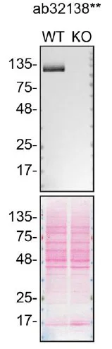 Western blot - Human PARP1 knockout HEK-293T cell line (AB266598)