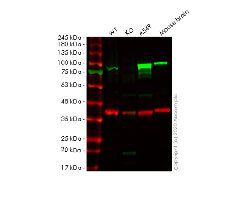 Western blot - Human PDE4B knockout HeLa cell lysate (AB257576)