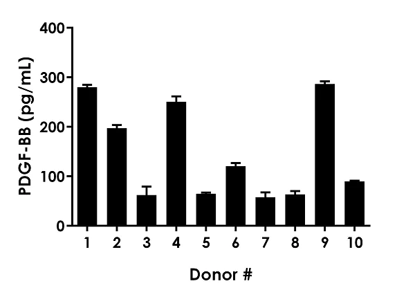 Sandwich ELISA - Human PDGF BB ELISA Kit (AB184860)