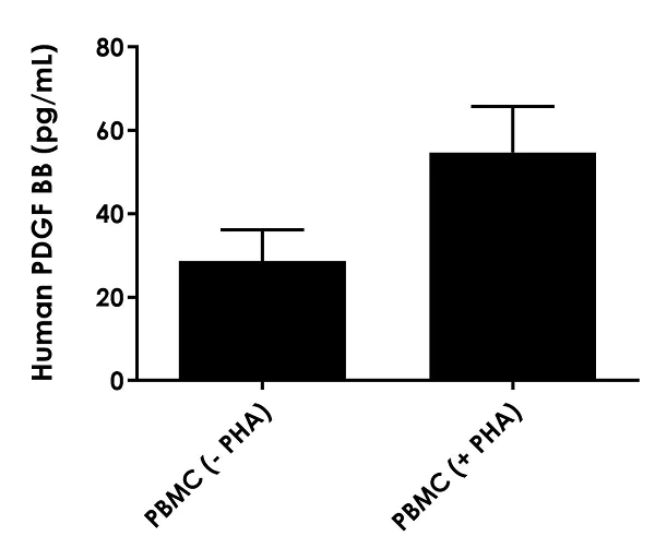 Sandwich ELISA - Human PDGF BB ELISA Kit, Fluorescent (AB229418)
