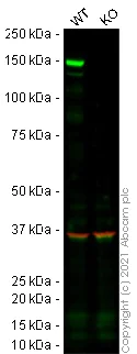 Western blot - Human PDGFRA knockout SH-SY5Y cell lysate (AB275522)