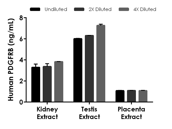 Sandwich ELISA - Human PDGFRB ELISA Kit (AB252357)