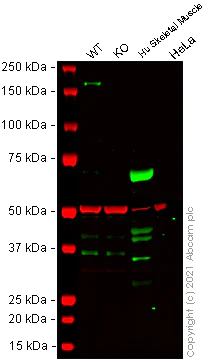 Western blot - Human PDGFRB knockout SH-SY5Y cell line (AB273749)