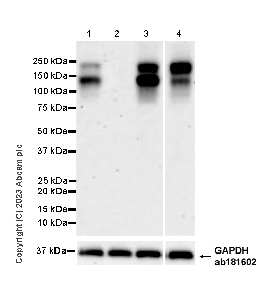 Western blot - Human PDGFRB knockout SH-SY5Y cell lysate (AB275523)