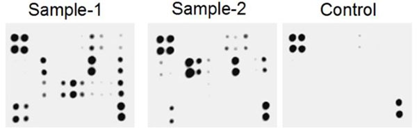 Multiplex Protein Detection - Human Periodontal Disease Antibody Array (Membrane, 20 Targets) (AB211064)