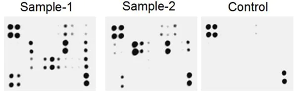 Multiplex Protein Detection - Human Periodontal Disease Antibody Array (Membrane, 20 Targets) (AB211064)
