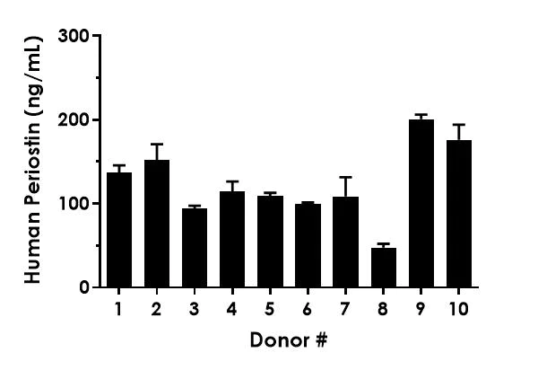 Sandwich ELISA - Human Periostin ELISA Kit (AB309314)