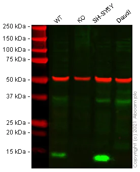 Western blot - Human PFN2 (Profilin 2) knockout HeLa cell lysate (AB258108)
