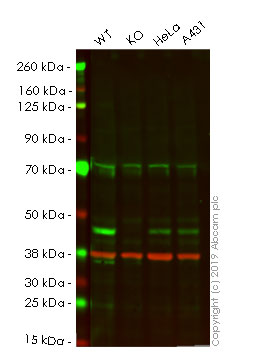 Western blot - Human PHF6 (PHD finger protein 6) knockout HEK-293 cell lysate (AB261661)