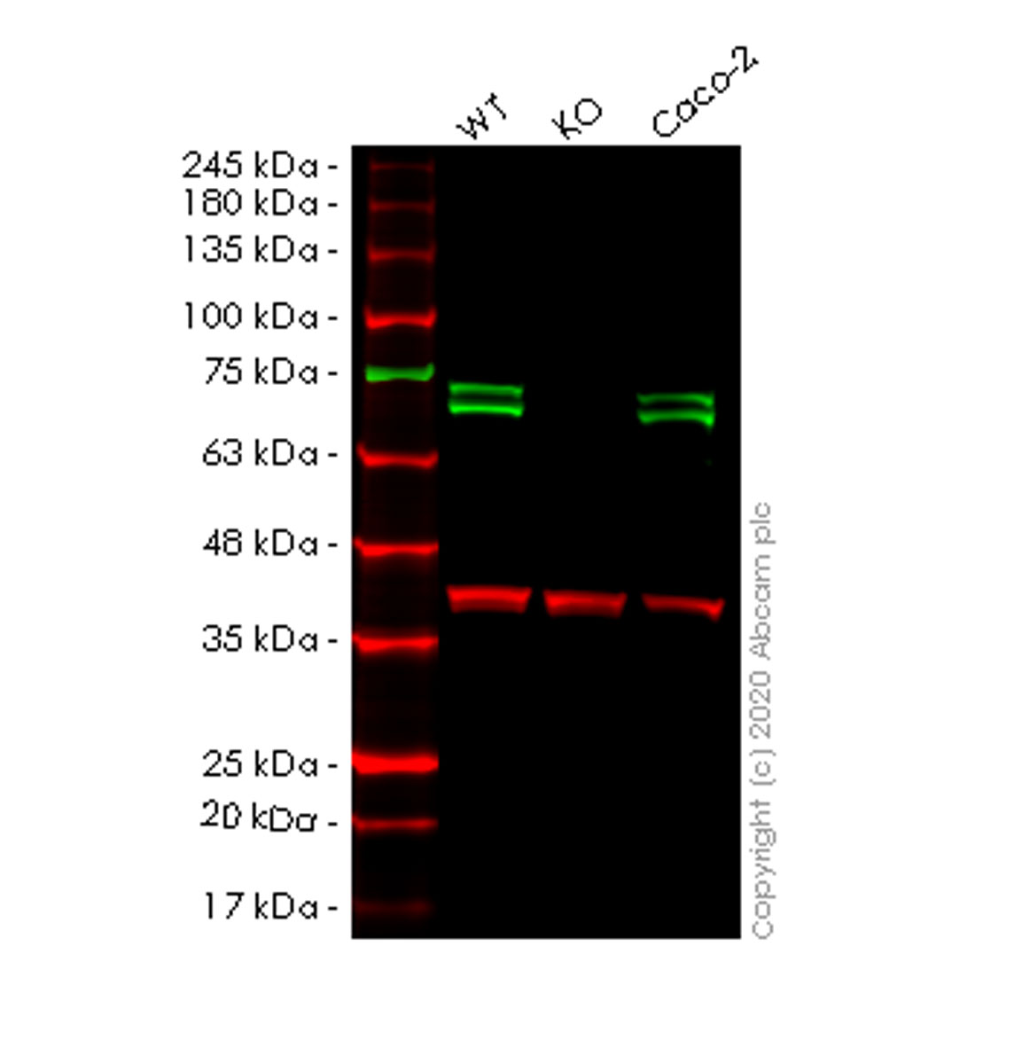 Western blot - Human PICALM knockout HeLa cell lysate (AB258113), expandable thumbnail
