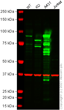Western blot - Human PKP3 (Plakophilin 3) knockout HeLa cell lysate (AB258120), expandable thumbnail
