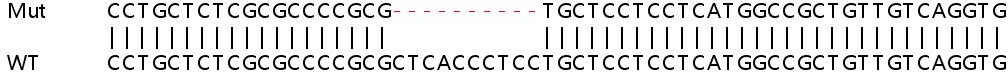 Sanger Sequencing - Human PLA2G12A (Phospholipase A2 XII) knockout HeLa cell lysate (AB263299), expandable thumbnail