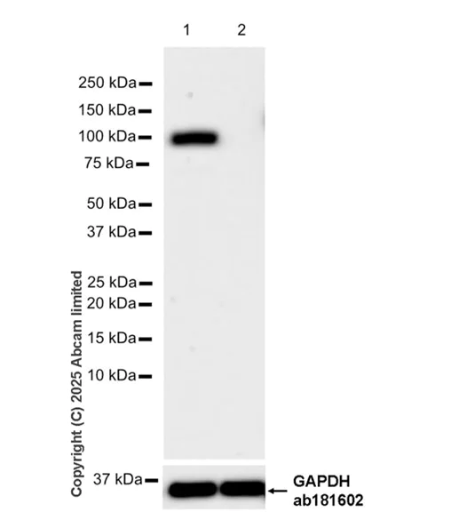 Western blot - Human PLA2G4A (Cytosolic Phospholipase A2) knockout HeLa cell lysate (AB257133)