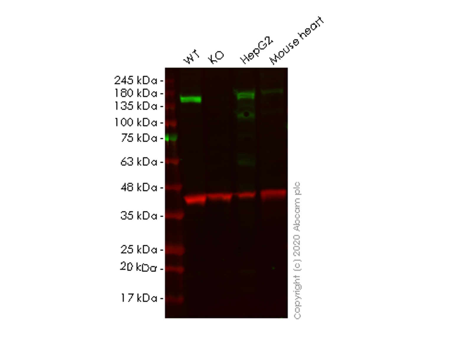 Western blot - Human Plcb1 (Phospholipase C beta 1) knockout HeLa cell lysate (AB257589)
