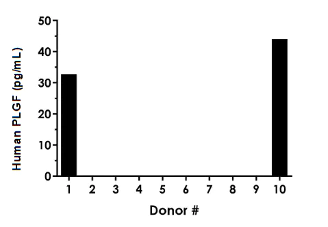 Sandwich ELISA - Human PLGF ELISA Kit (AB260056)