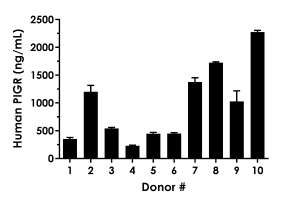 Sandwich ELISA - Human Polymeric immunoglobulin receptor ELISA Kit (PIGR) (AB282302)