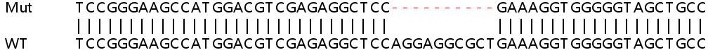 Human PPP4R2 knockout HEK-293T cell lysate