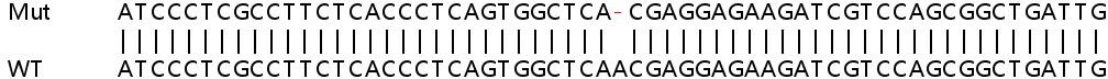 Human PPP6R1 (SAPS1) knockout HEK-293T cell lysate