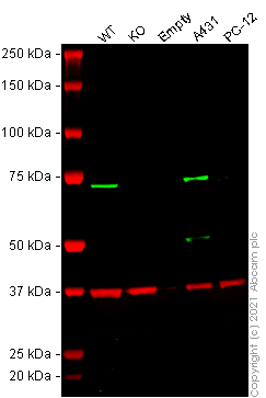 Western blot - Human PRKCI (PKC iota) knockout HeLa cell line (AB264670), expandable thumbnail