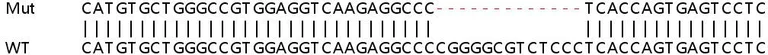 Sanger Sequencing - Human PRKCSH (Glucosidase 2 subunit beta) knockout HEK-293T cell line (AB266770)